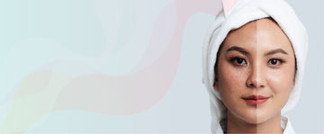 The Best Melasma Treatment Products And Kits