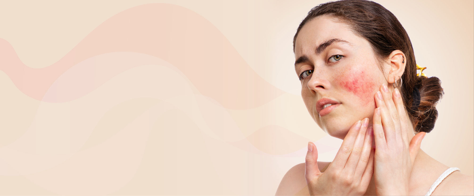 The Best Rosacea Treatment Products and Kits