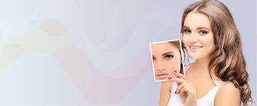The Best Scar Treatment Products and Kits